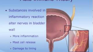 Understanding Interstitial Cystitis IC [upl. by Eibur584]