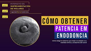 Cómo Obtener patencia em Endodoncia [upl. by Nayhr803]