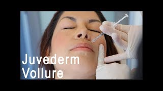 Antiaging with Juvederm Vollure For Volume in Nasolabial Fold [upl. by Sjoberg955]