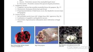 USMLE CELL DEATH Pathoma lectures [upl. by Yelnik273]