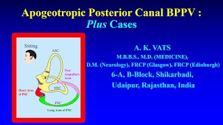 Apogeotropic Posterior Canal BPPV  Newer Insights [upl. by Asilehs584]