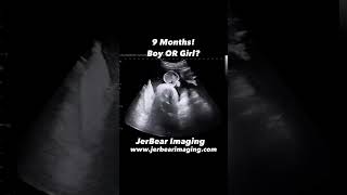 Gender Reveal jerbearimaging 9monthpregnancy girlorboy genderreveal [upl. by Darrin]