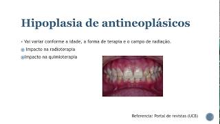 Anomalias dentárias 01 Resumos de odonto [upl. by Jillana822]