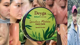 Deyga Spirulina Matcha Face Pack  Honest Review [upl. by Euqinitram]