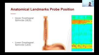 Manometry 101 What is Manometry Evolution How it Works and How its Performed [upl. by Thoma764]