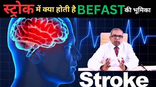 ब्रेन स्ट्रोक में दिमाग की 19 लाख कोशिकाएं मरती जाती है हर मिनट अपनाएं BEFAST ऐसे [upl. by Atinrahs506]