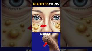 8 Early Warning Signs You Have Diabetes [upl. by Romano]