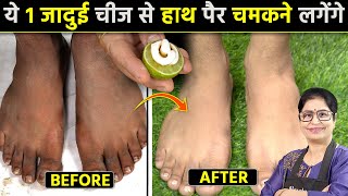 दुनिया का सबसे आसान तरीका जो हाथ पैर गर्दन को चमका देगा 1 ही बार में 100 Result  Feet Brightening [upl. by Atinahs]