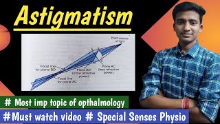 Astigmatism  Errors Of Refraction Special Senses  Physiology  in hindi By Ashish Agrawal [upl. by Noreik433]