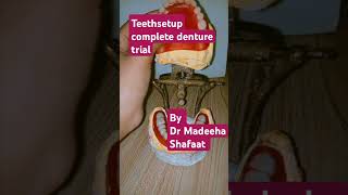 Complete denture trial dentist dentition denture denturelife dentalcare satisfying dentista [upl. by Shanahan547]