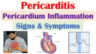 Pericarditis Pericardial Inflammation Signs amp Symptoms amp Why They Occur [upl. by Dorine]