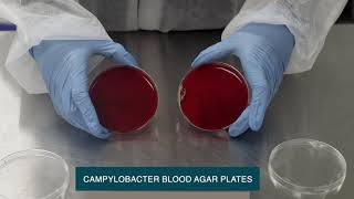 Unveiling Microbial Growth Revealing Microbial Growth on Various Agar Media [upl. by Dickens]