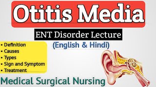 Otitis Media  Otitis Media In Hindi [upl. by Dittman710]