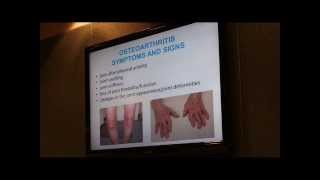 Osteoarthritis Presentation Part 1 [upl. by Oijimer4]