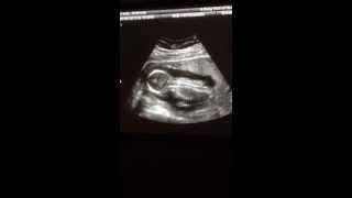 16 week ultrasound and Its a boy [upl. by Wainwright]