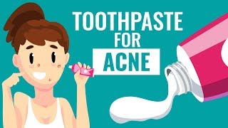 Is Using Toothpaste For Acne safe  Know the Truth [upl. by Sitnik]