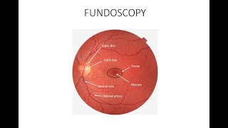 HOW TO DO FUNDOSCOPY OR OPHTHALMOSCOPY [upl. by Nnyletak]