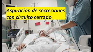 Aspiración de secreciones con circuito cerrado [upl. by Viguerie]