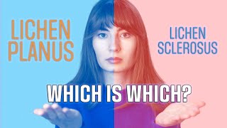 Lichen Sclerosus and lichen planus whats the difference [upl. by Kazmirci11]