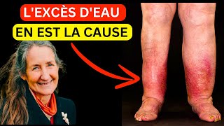 15 ans de jambes et de pieds enflés disparus en quelques minutes  La découverte de Barbara ONeill [upl. by Jammal]