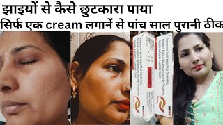 Cream For Pigmentation Pigmentation Removal Cream Skin Whitening Cream  झाइयां। [upl. by Rakso625]