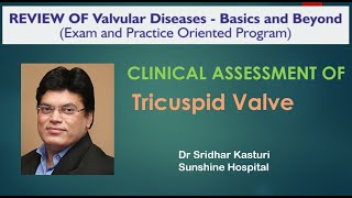 Clinical assessment of Tricuspid Valve Diseases Dr Vamshi Krishna [upl. by Artina608]