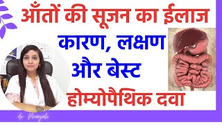 आंतों की सूजन का इलाज  aanto ki sujan ka ilaj homeopathic  aanto ki sujan ke lakshan aur karan [upl. by Ayanej]