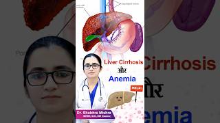 Liver cirrhosis or anemia shorts [upl. by Ikey856]