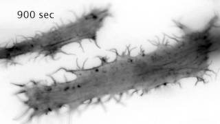 FTractin reports periodic Factin waves [upl. by Atelokin]