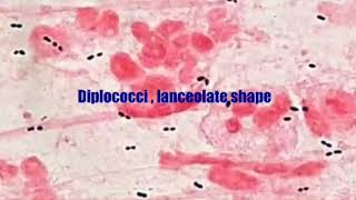 Gram stain of pneumococcus [upl. by Abercromby279]