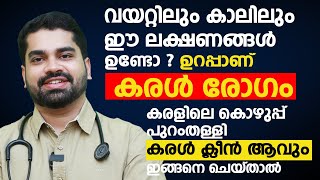 കരളിലെ കൊഴുപ്പ് പുറംതള്ളി കരൾ ക്ലീൻ ആവും ഇങ്ങനെ ചെയ്താൽ  Fatty Liver and Liver Disease Malayalam [upl. by Mariano634]