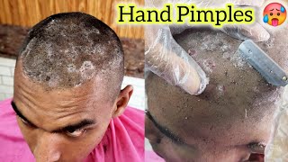 HeadShave😌Homeless Elegant The Most Attractive Dandruff Remove Head Shave Tutorial 2024 solution ❓ [upl. by Goodden]