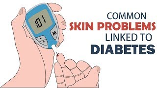 Common Skin Problems Linked to Diabetes [upl. by Tansy]