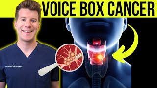 Doctor explains Laryngeal cancer voicebox cancer  Symptoms causes and treatment [upl. by Sset170]