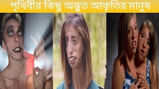 না দেখলে বিশ্বাস করতে পারবেন না এমন মানুষ ও আছে [upl. by Ayrad]