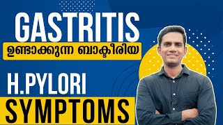 Hpylori symptoms I Dr Sijil K S [upl. by Gwenn710]