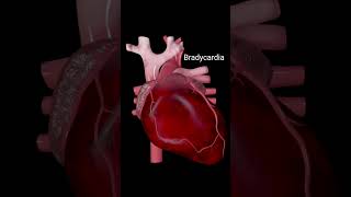 Heart anatomy heartattack heartbeat bradycardia 3danimation [upl. by Amanda415]