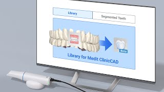 Whats new in Medit Ortho Simulation v140 amp Medit ClinicCAD v095 [upl. by Schnur]