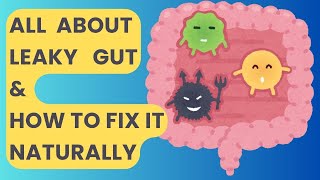 What is Leaky Gut and How to Fix it Naturally Backed by Science [upl. by Yniattirb]