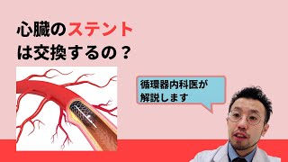 心臓のステントは交換するの？【医師による解説】 [upl. by Ikcaj]