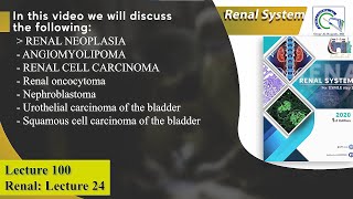 Renal cell carcinoma  Nephroblastoma Wilms tumor  Transitional cell carcinoma of the bladder [upl. by Atinreb]