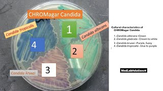 Candida species identification using Candida Chromagar│ C albicans│ C topicalis│ glabarata│krusei [upl. by Fi]