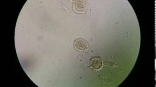 Fertilised decorticated egg of Ascaris lumbricoides [upl. by Macknair]