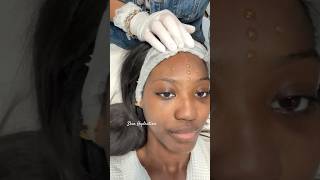 Hydrating Ampule  Skincare90210 esthetician beverlyhills skincare90210 antiaging bestFacial [upl. by Judon]