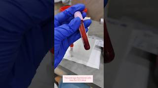 Hba1c test laboratorylife hba1c bloodsugar bloodcollection ytshorts bloodtest ytstudio rbc [upl. by Fernald263]