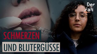 Influencerin spritzt illegal Hyaluronsäure  Der Fall Duygu Ö [upl. by Ayoj240]