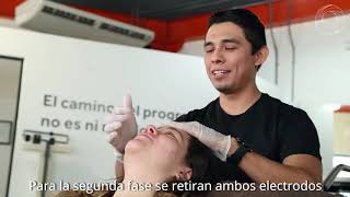 ¿En qué consiste la terapia de parálisis facial [upl. by Leuqcar884]