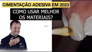 Cimentação adesiva em 2023 como usar melhor os materiais [upl. by Enidlarej]