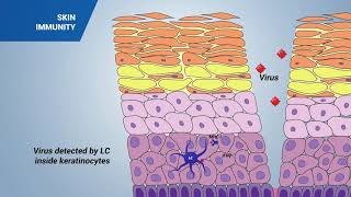 Immune response in the skin [upl. by Nnairrek]