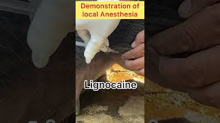 Lignocaine l Medial patellar Desmotomy l MPD l Dr Umar Khan [upl. by Singhal]